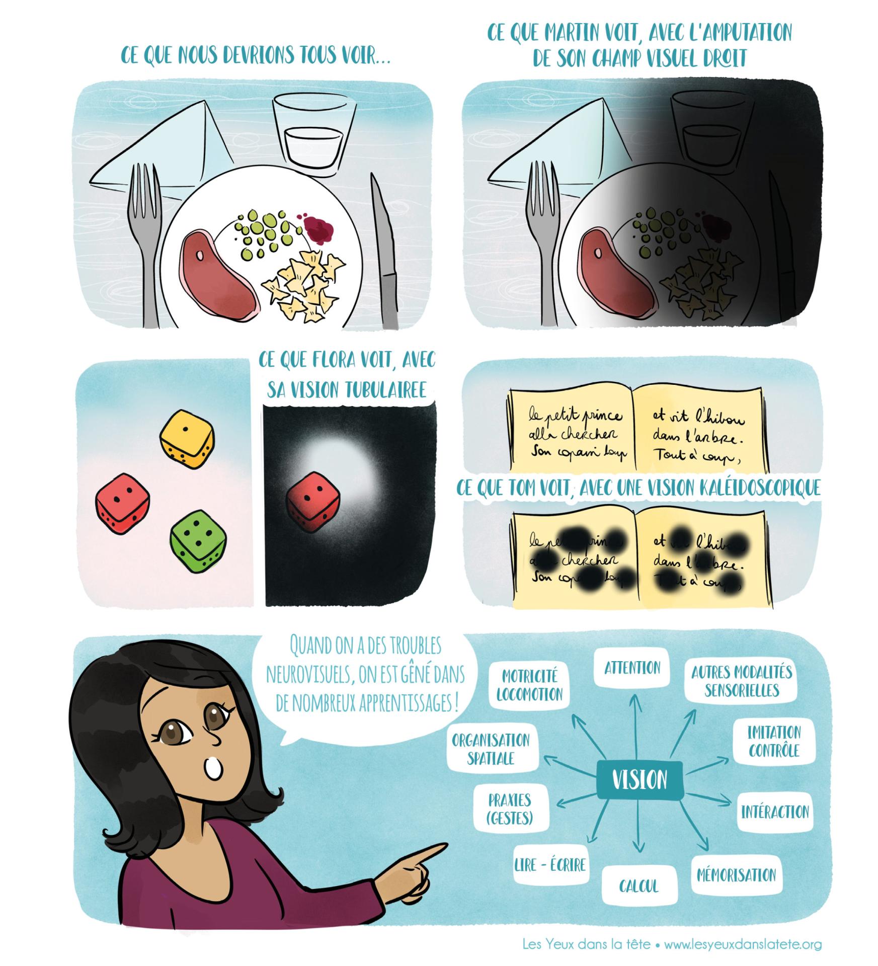 4 troubles neurovisuels planche 2 scaled 1